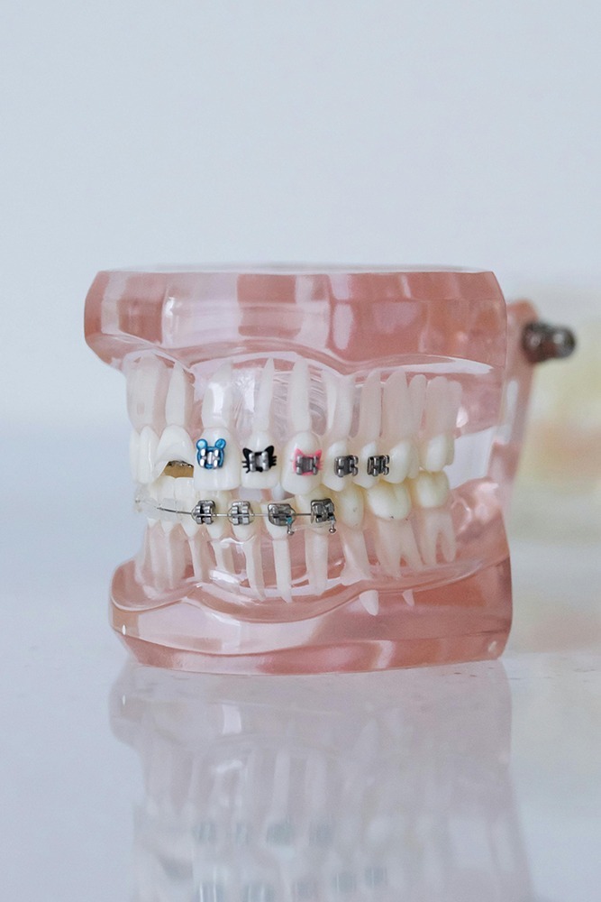 Brackets y ortodoncia para niños